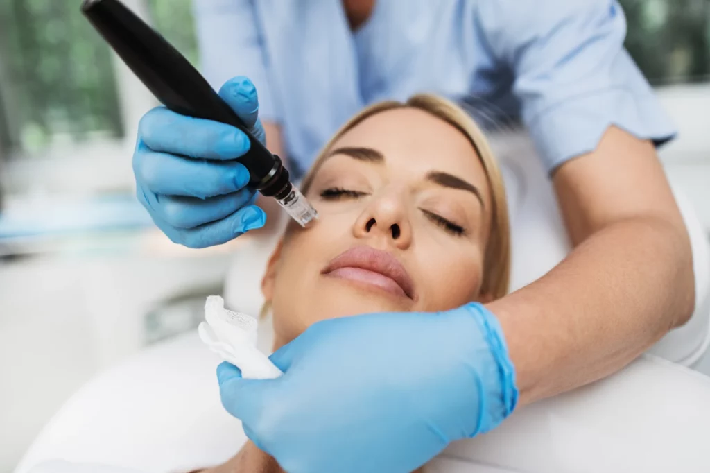 Microneedling