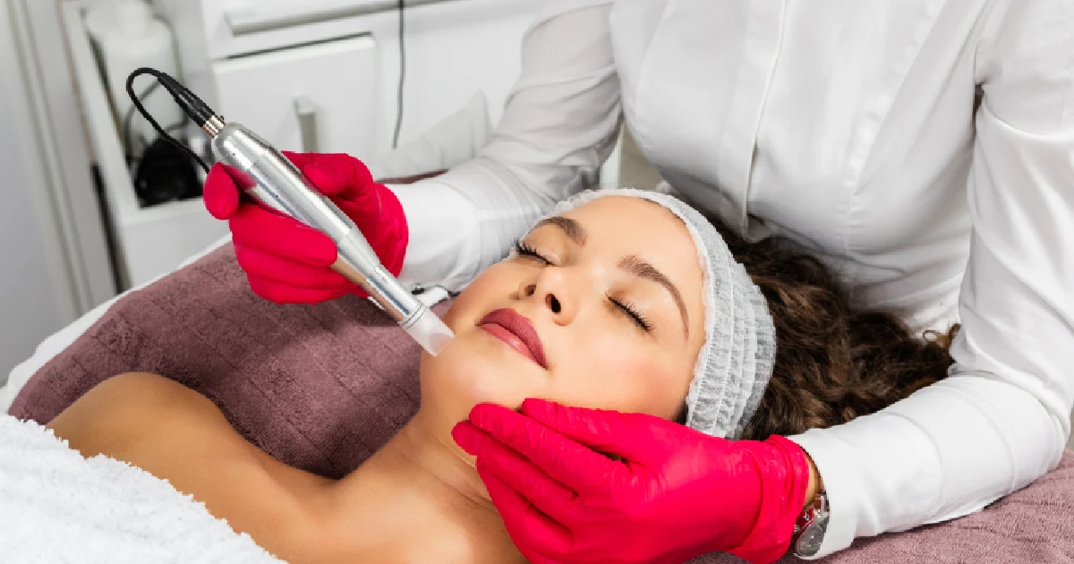 Woman receiving microneedling treatment in Roswell, GA for skin rejuvenation