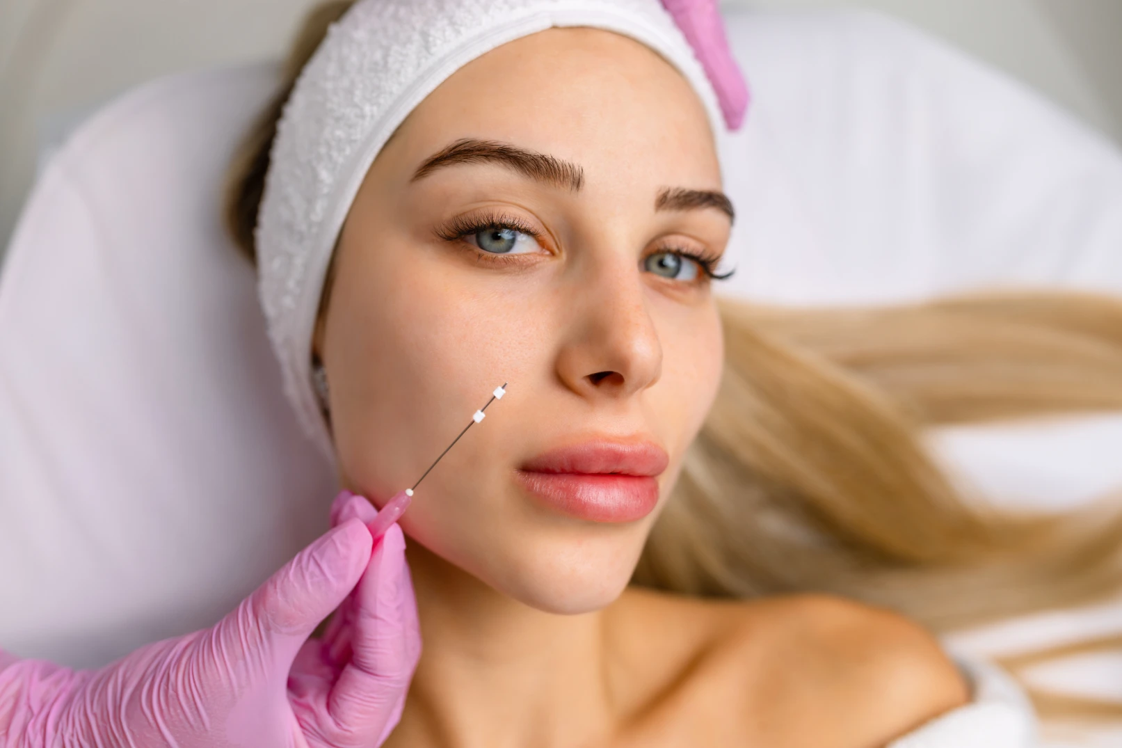 a woman getting PDO Thread Lifts